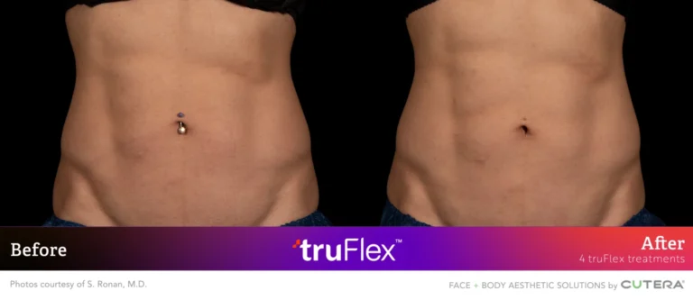 Ronan-4Txs-BA-1-1536x665