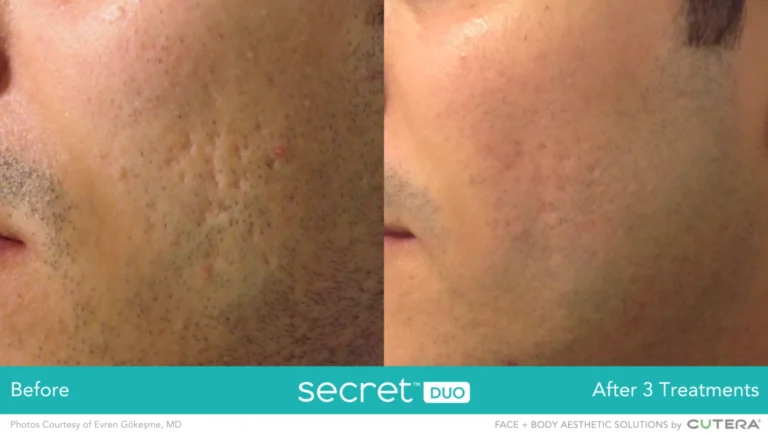 Secret-DUO-BA_Gokesme4-1536x870