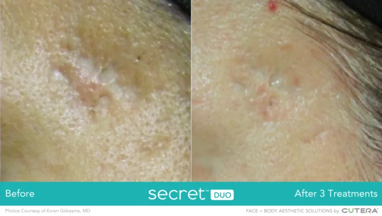 Secret-DUO-BA_Gokesme5-1536x870