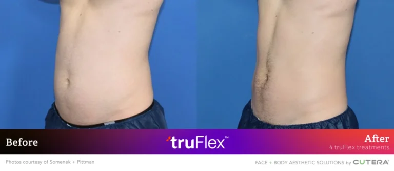 Somenek-Pittman-4Txs-BA-1-1536x665